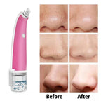 4 in 1 Water Bubble Blackhead Remover