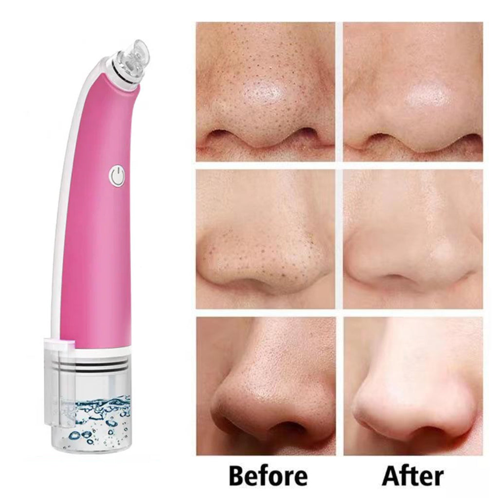 4 in 1 Water Bubble Blackhead Remover