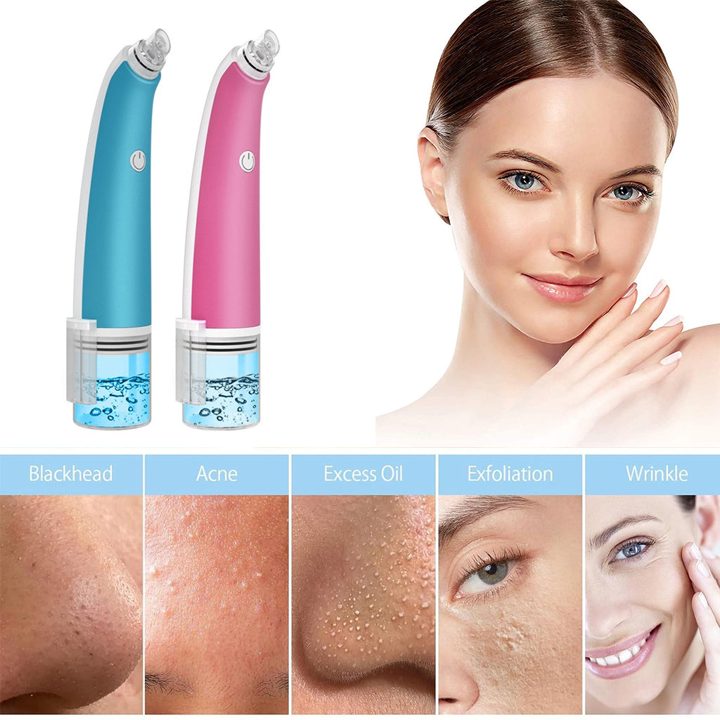 4 in 1 Water Bubble Blackhead Remover