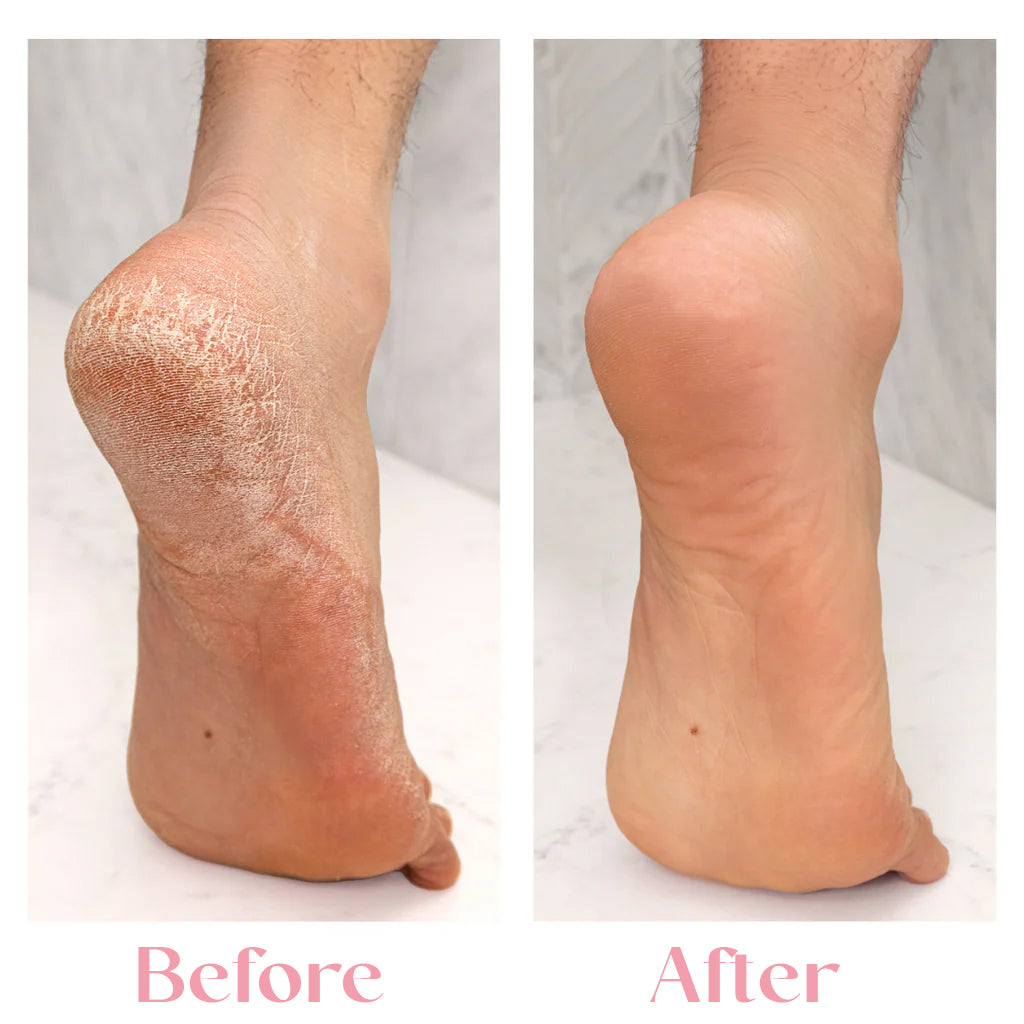 2 in 1 Electric Pedicure Tool For Dead Skin Remover