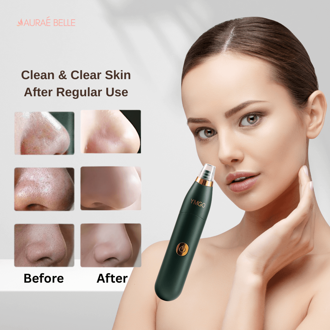 Auraébelle Electric Blackhead, Pimple Remover & Pores Cleaner